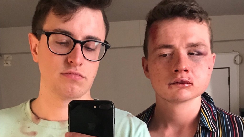 Gewaltsamer Überfall auf schwules Paar // © gofundme.com