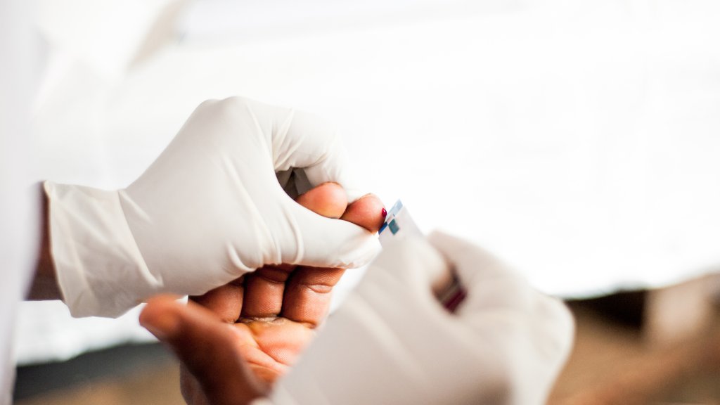 Unzureichende HIV-Tests // © beingbonny