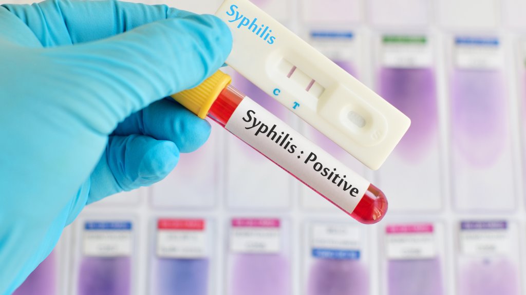 Syphilis-Erkrankungen in Deutschland verdoppelt // © jarun011