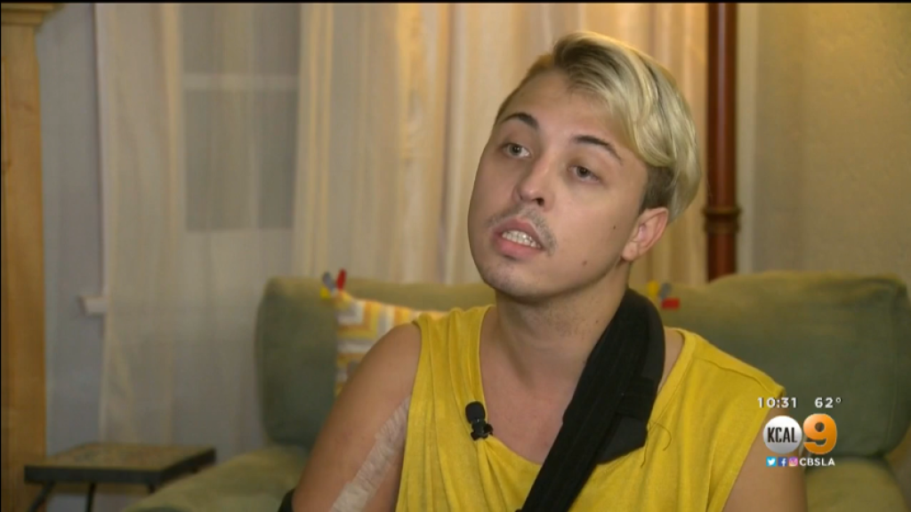 Drag-Queen landet im Krankenhaus