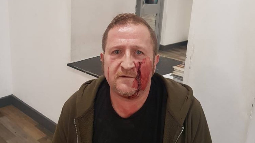 Marc Power mit Hammer zugerichtet