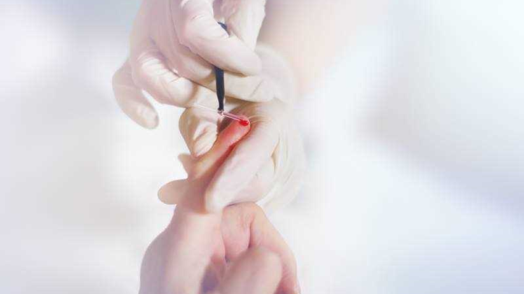 HIV-Test & Mehr // © Archiv