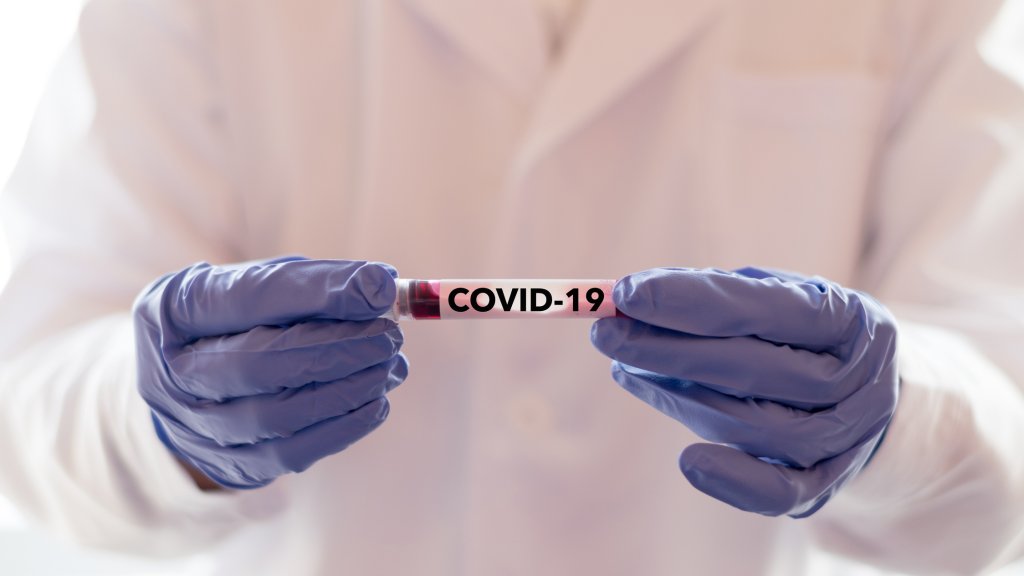HIV-Medikamente als Corona-Heilung