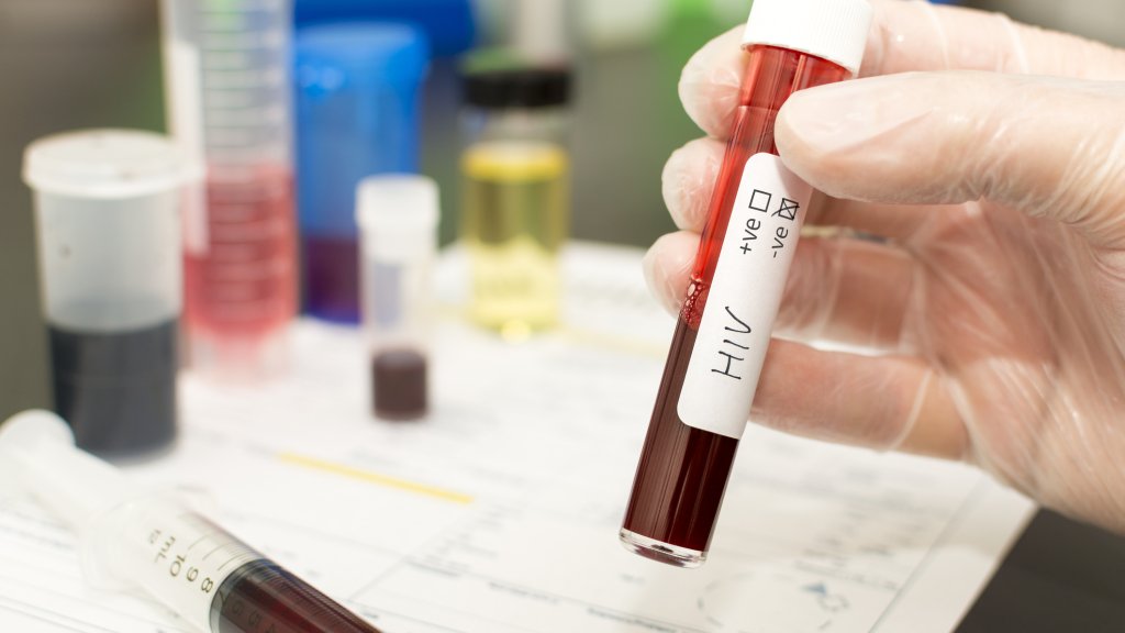 Riskante Stammzellen-Transplantation heilt Aids