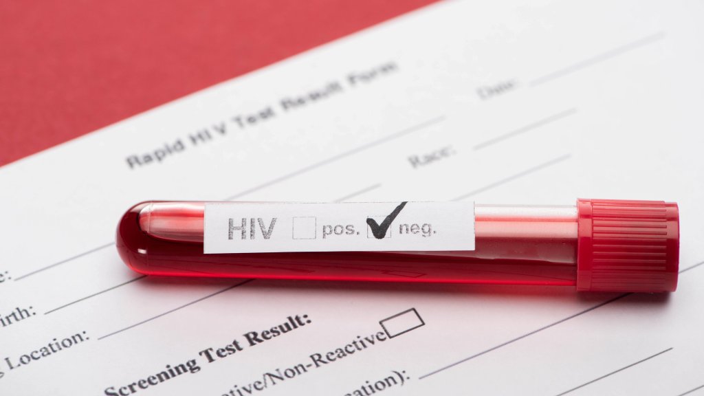 Kostenfreie HIV-Selbsttests während dem Lockdown
