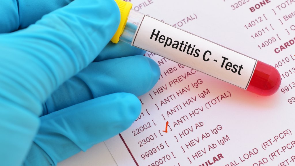 Hepatitis // © jarun011