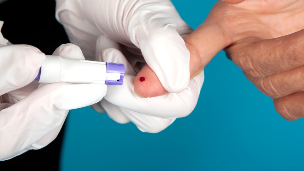 HIV-Schnelltest für Männer und Trans*Menschen in Lübeck