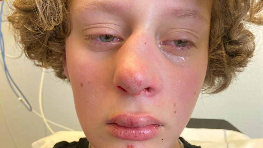 Angriff auf 14-jährige Amsterdamerin 