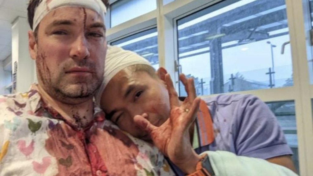 Drei Verdächtige festgenommen, weil sie ein Paar verprügelten