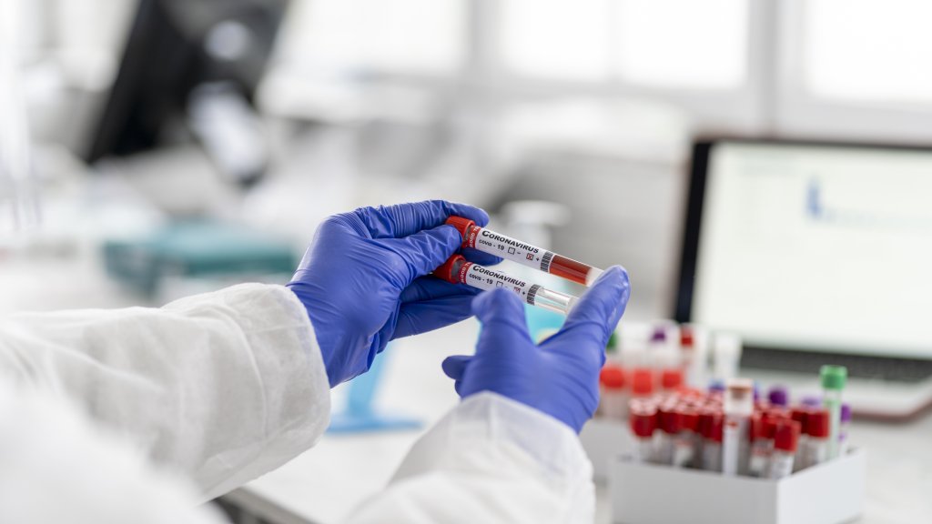 Geimpfte sollen bis Weihnachten Aids entwickeln