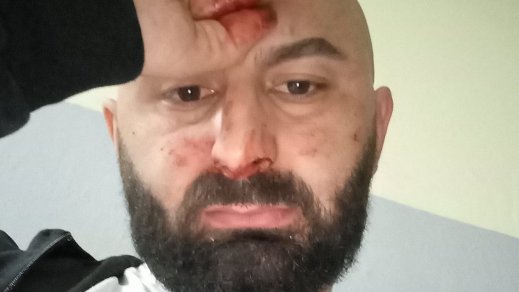 LGBTI*-Aktivist aus Montenegro beim Grabbesuch verprügelt