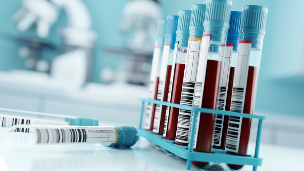 Verlorene Jahre im US-Kampf gegen HIV // © :solarseven