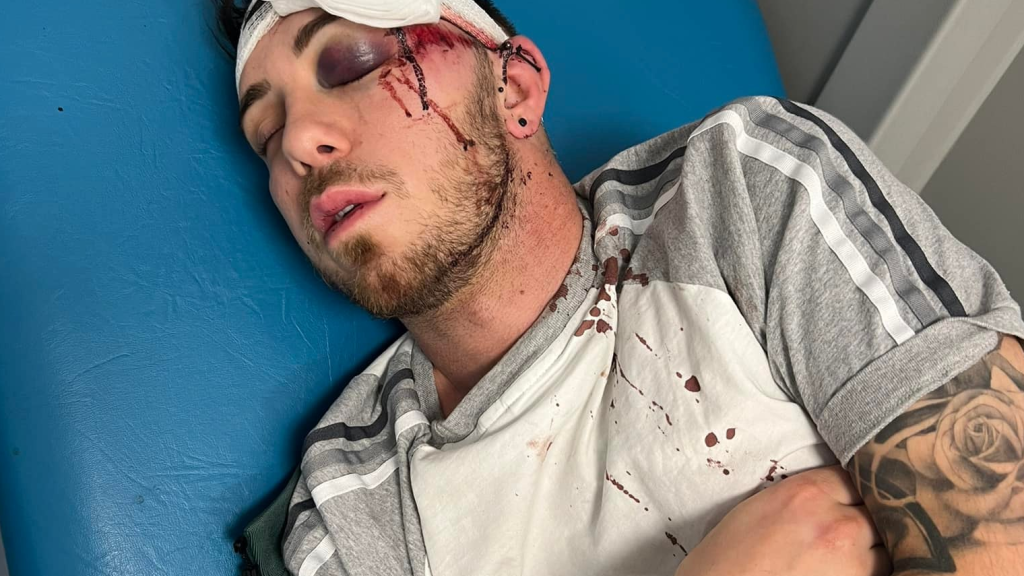 Homophober Mob schlägt auf schwules Paar ein // © facebook.com