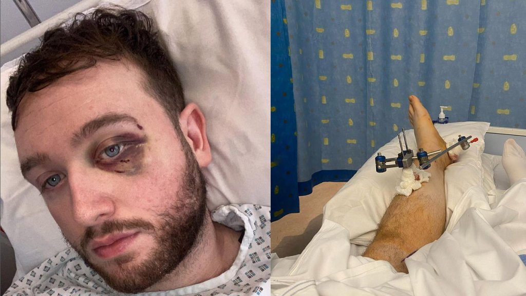 Karriereaus nach Angriff auf Gay-Sportler? 