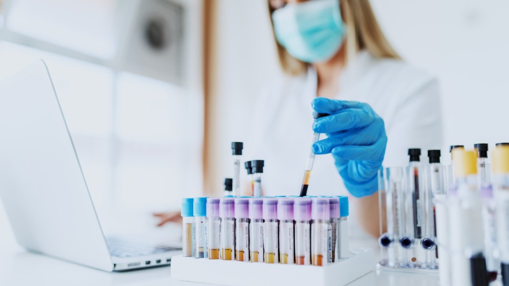 Pharma-Unternehmen startet nach Rückschlag neue Studien