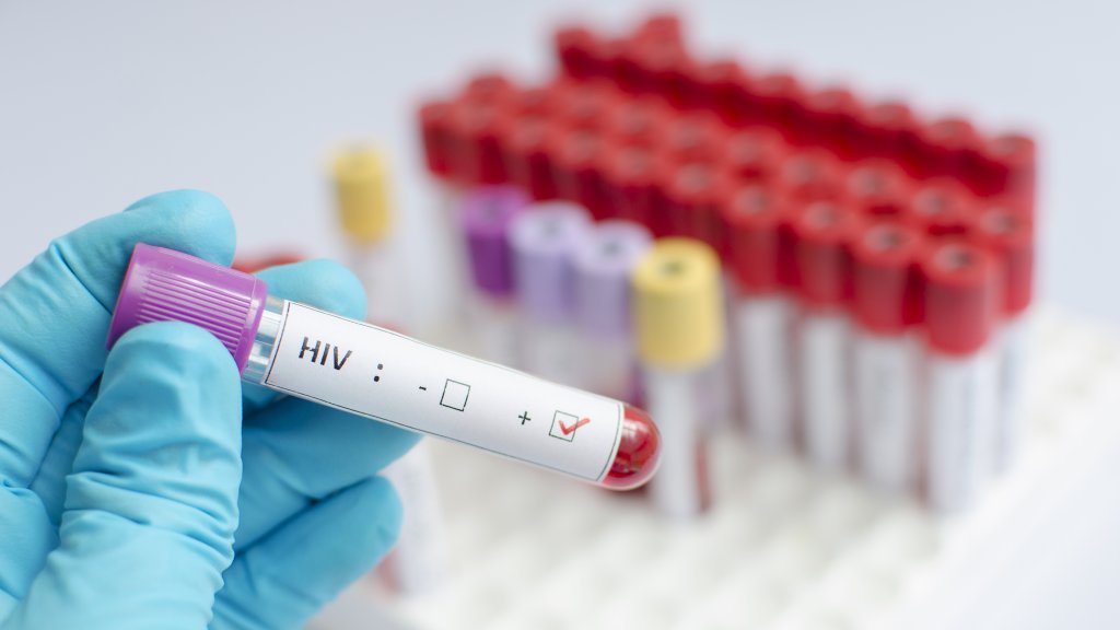 Weniger HIV-Fälle bei Schwulen