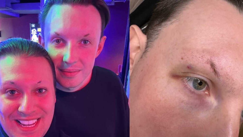 Drag-Queen-Ehepaar fürs Händchenhalten angegriffen