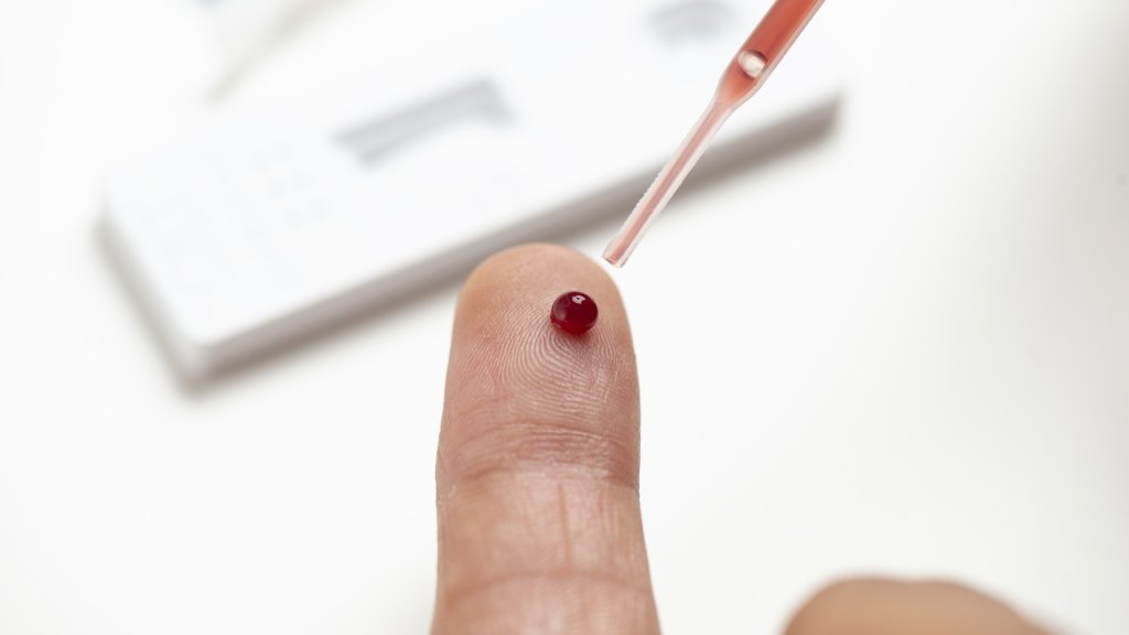 Revolution bei HIV-Tests!