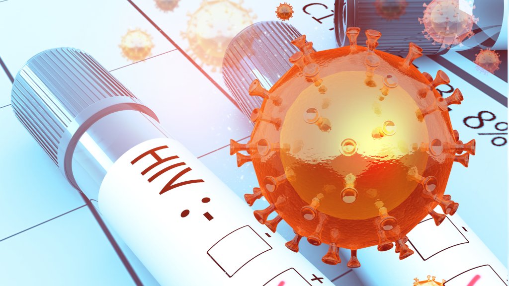 HIV-Forschung