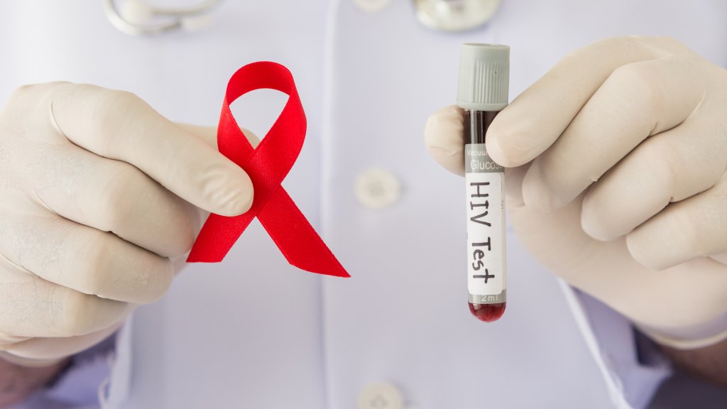 KOSTENLOSE STI- UND HIV-TESTS