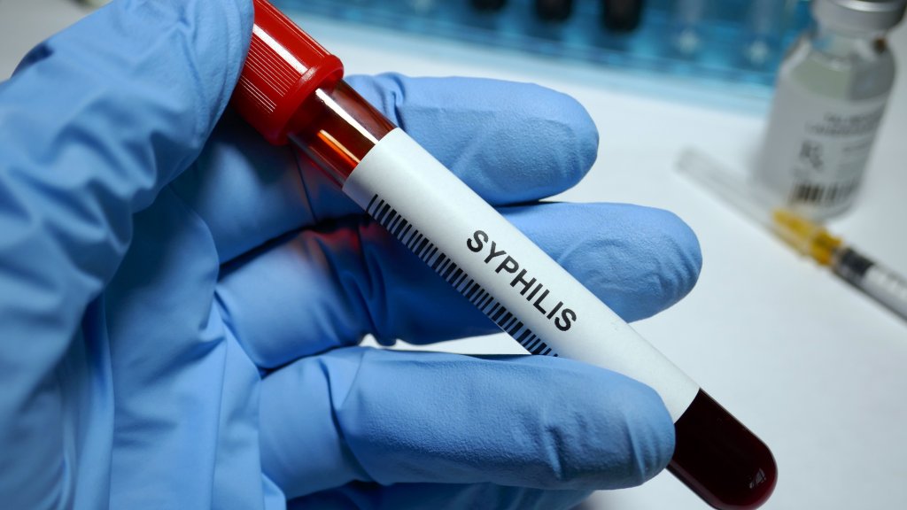Siegeszug der Syphilis