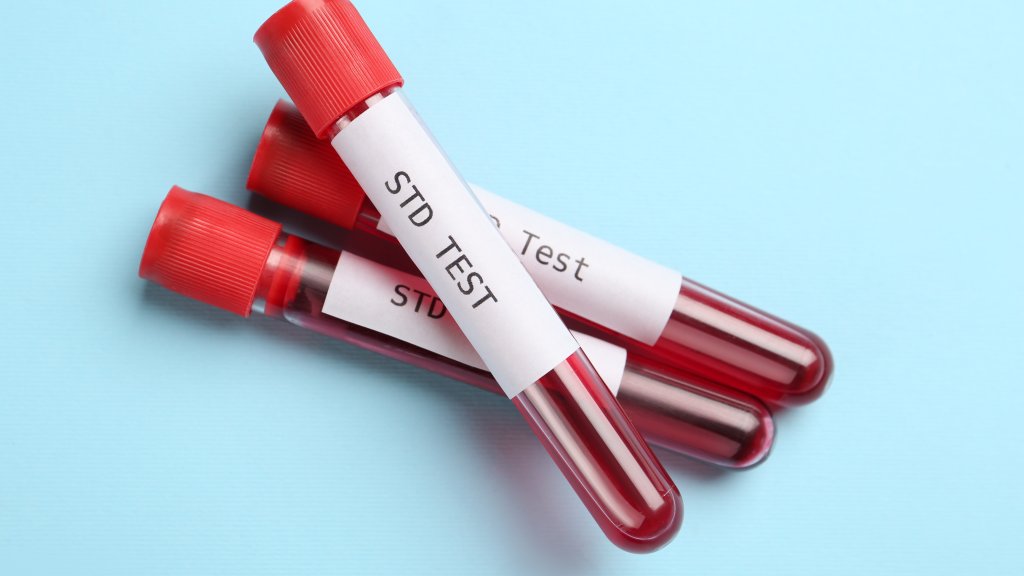 HIV- UND STI-TESTS UND BERATUNG