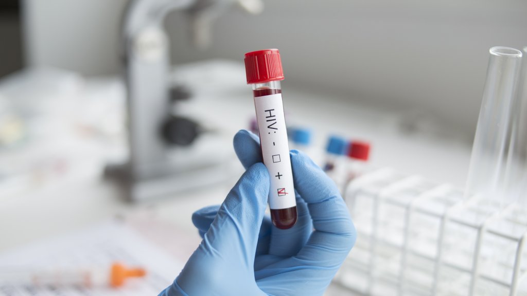 Medizinischer HIV-Jahresrückblick