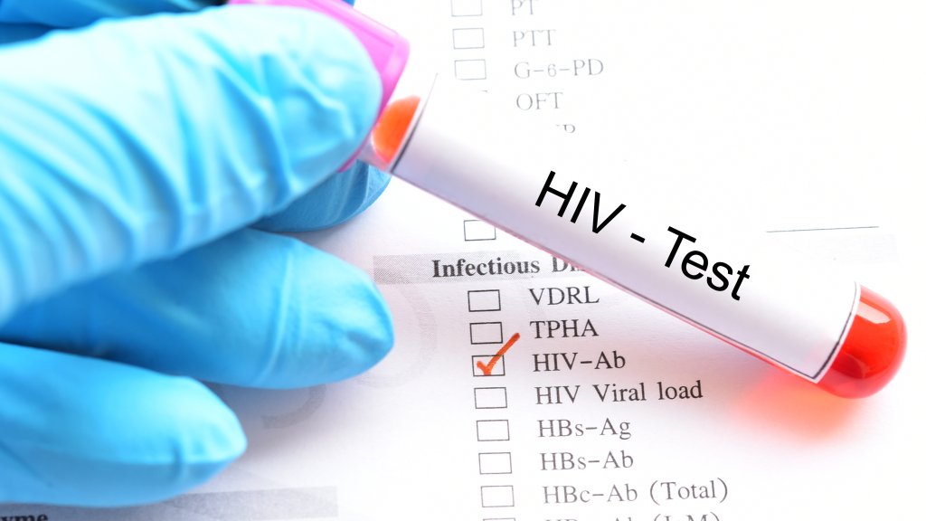 STI-Tests auch bei Schmuddelwetter