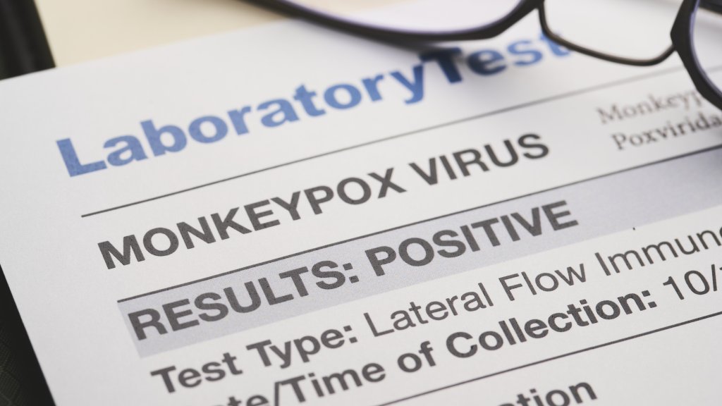 Mpox in den USA