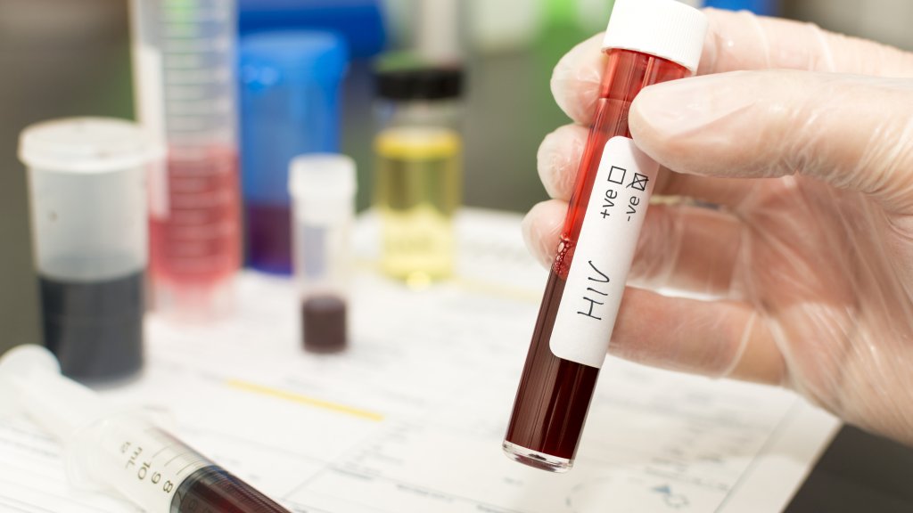 HIV-Neuinfektionen 