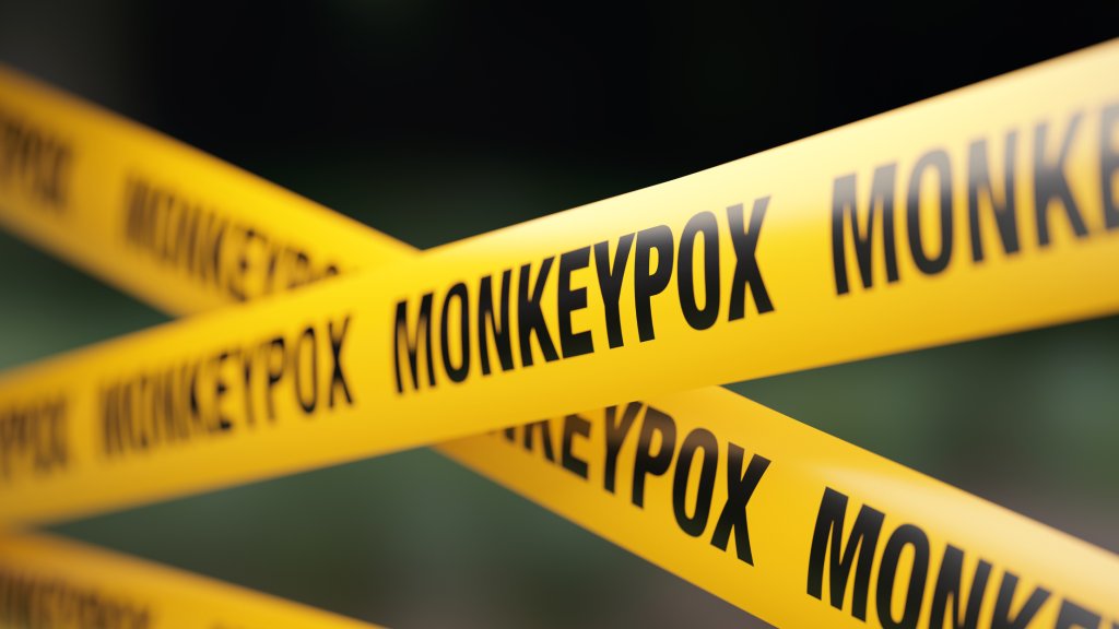Höchste Alarmstufe wegen Mpox