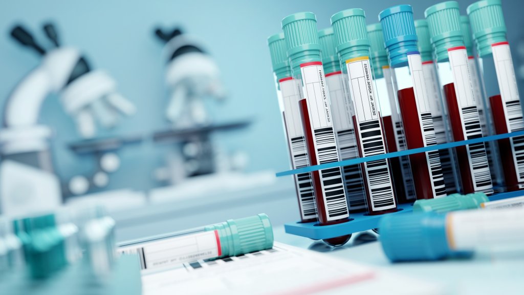 HIV-Diagnosen in Deutschland 