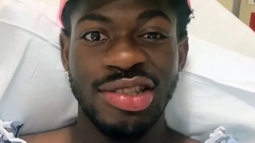 Gesichtslähmung bei Lil Nas X