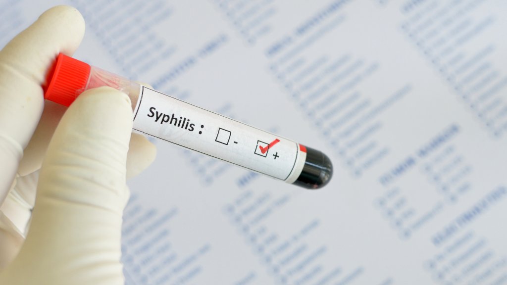 Neuer Anstieg der Syphilis-Fälle