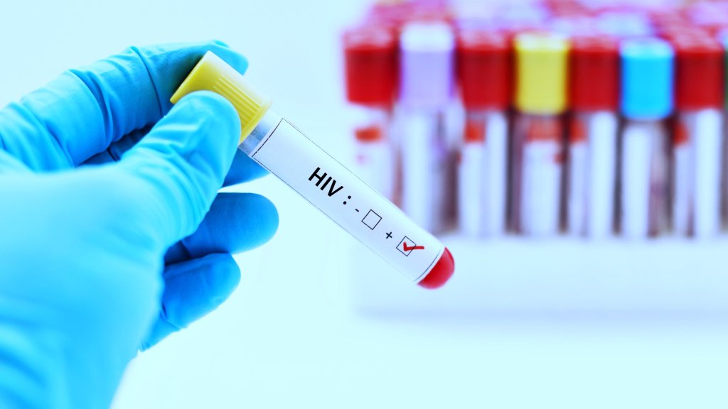 HIV-Infektionen steigen an