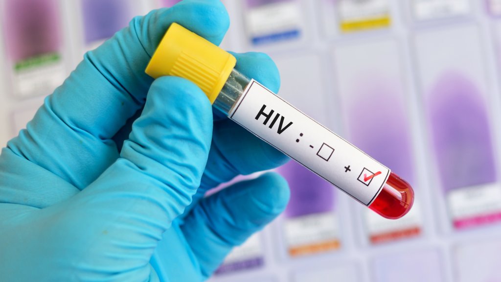 Anstieg von HIV-Neuinfektionen