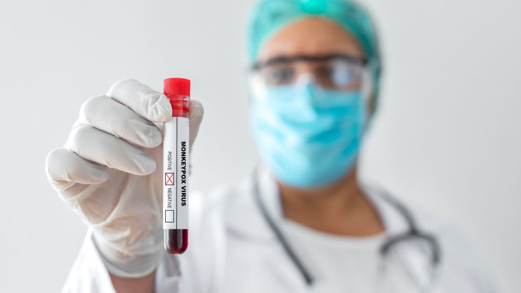 Neue Mpox-Variante in Österreich 