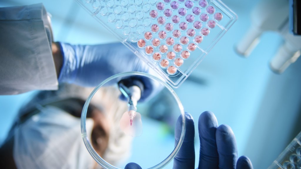 Fortschritte im Bereich HIV