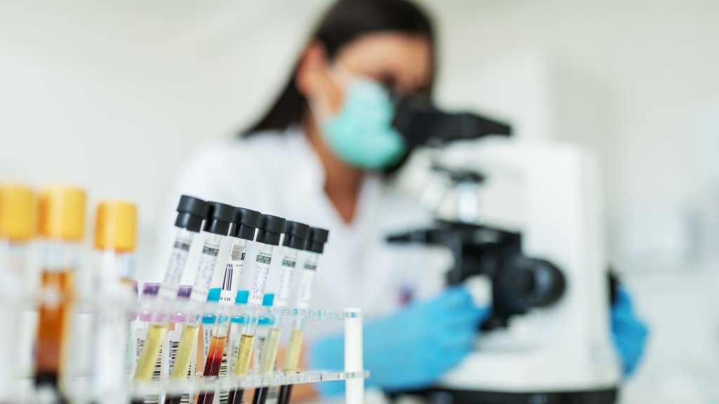 Fortschritte bei HIV-Therapie