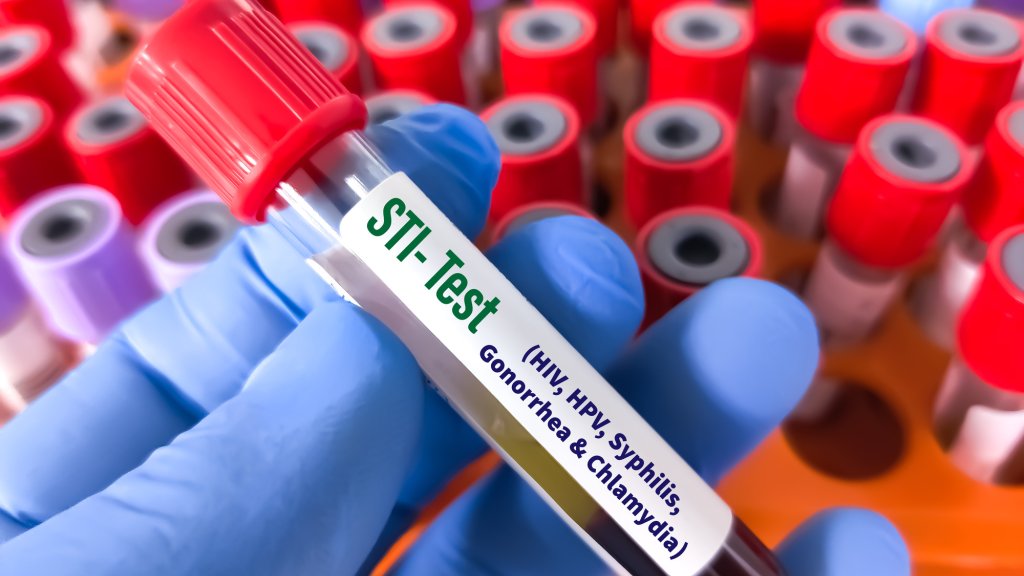 STI-Test (Symbolbild)