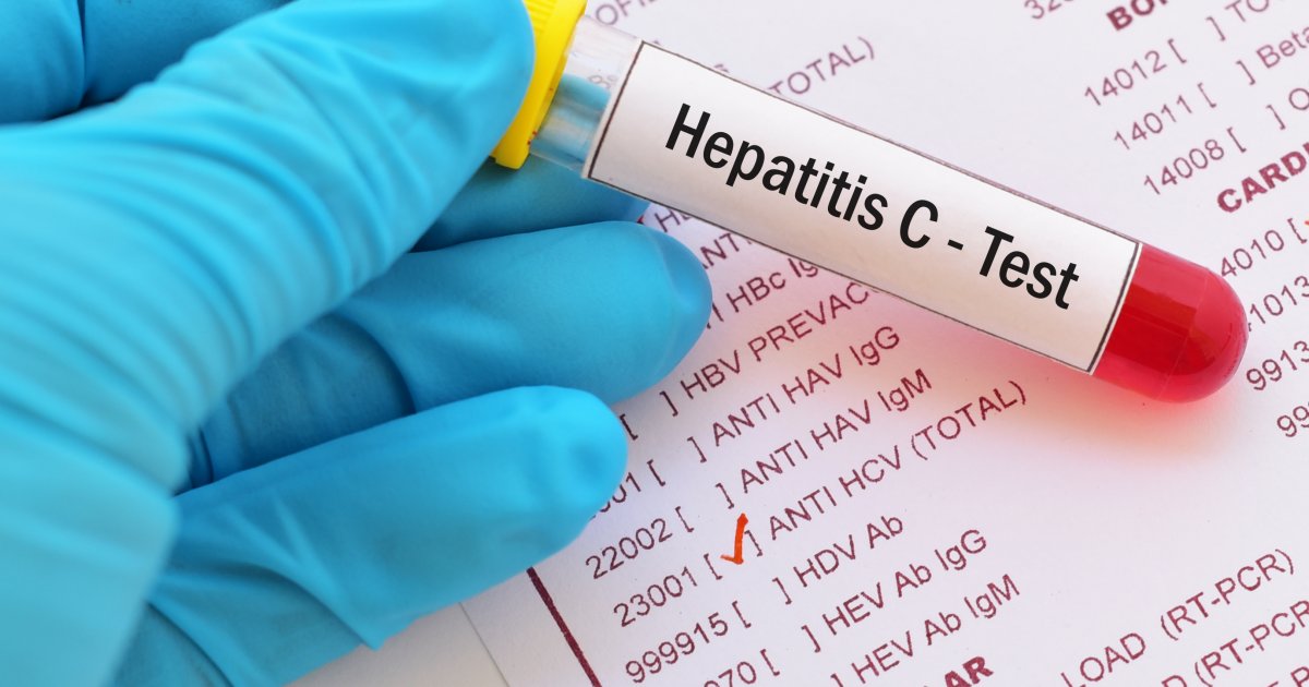 Hepatitis - Alle Infos Von A Bis E