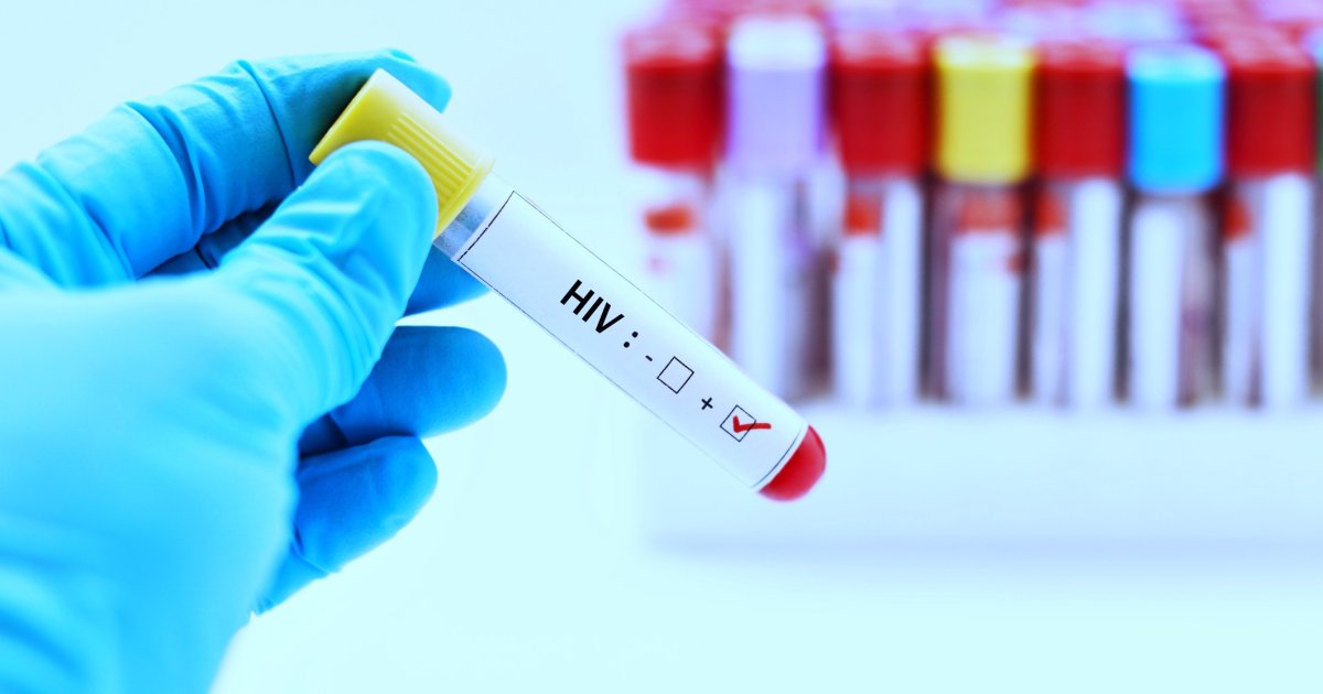 HIV-Infektionen-steigen-an-RKI-verzeichnet-2-300-Neu-Infektionen-im-Jahr-2024