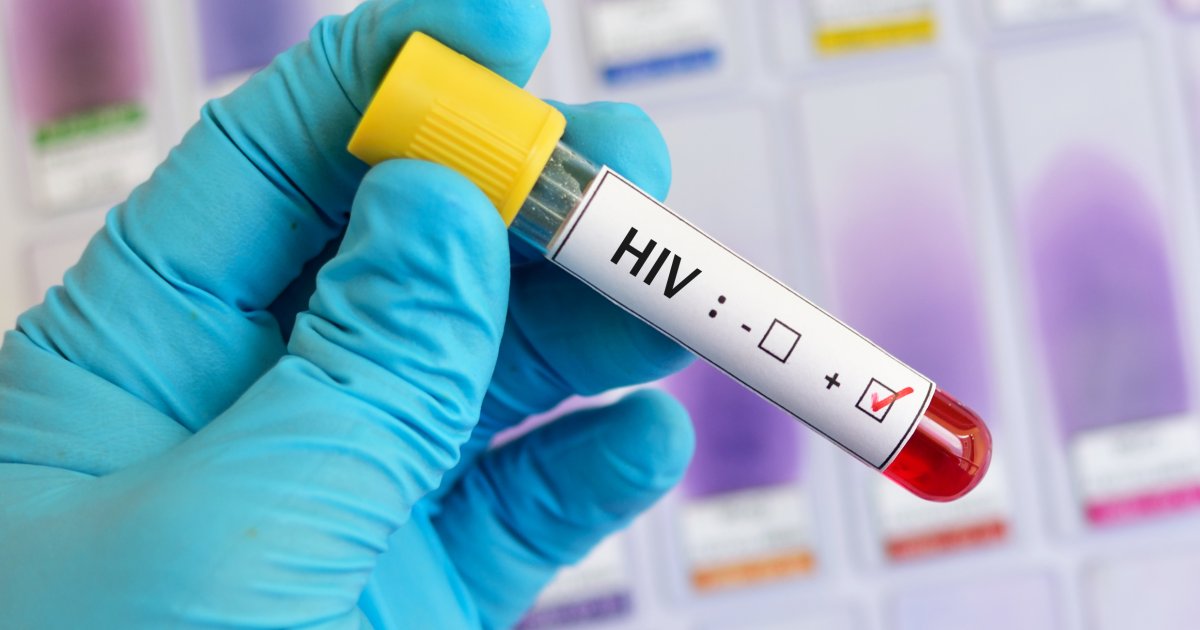 Anstieg-von-HIV-Neuinfektionen-HIV-Experten-warnen-vor-Testl-cken