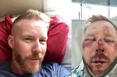 Barry Miles wird für mehrere Wochen im Krankenhaus bleiben müssen