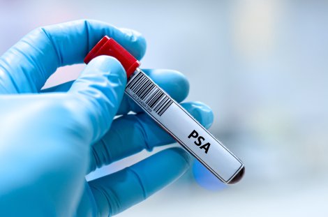 © iStock / kitsawet saethao