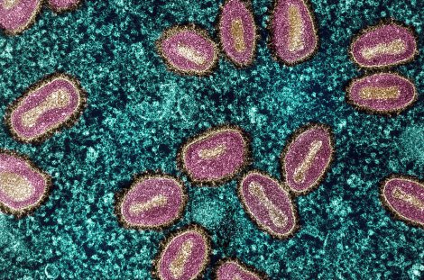 Mikroskopische Aufnahme von Mpox-Viren.