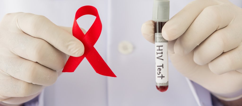 Ärzte raten von HIV-Tests aus dem Supermarkt ab // © utah778