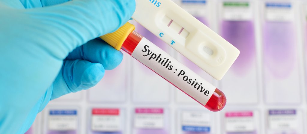 Syphilis-Erkrankungen in Deutschland verdoppelt // © jarun011
