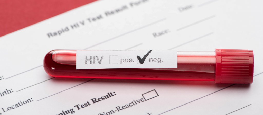 Kostenfreie HIV-Selbsttests während dem Lockdown