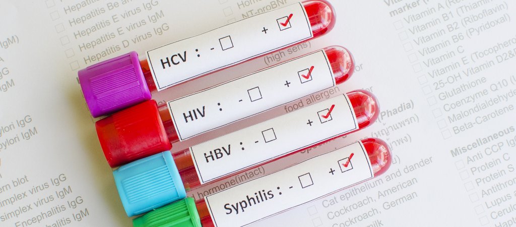 HIV-SYPHILIS-SCHNELLTESTS